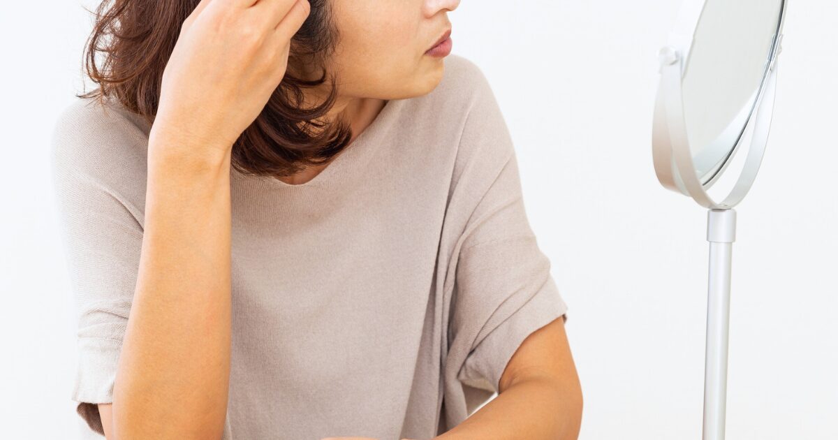 薄毛　女性