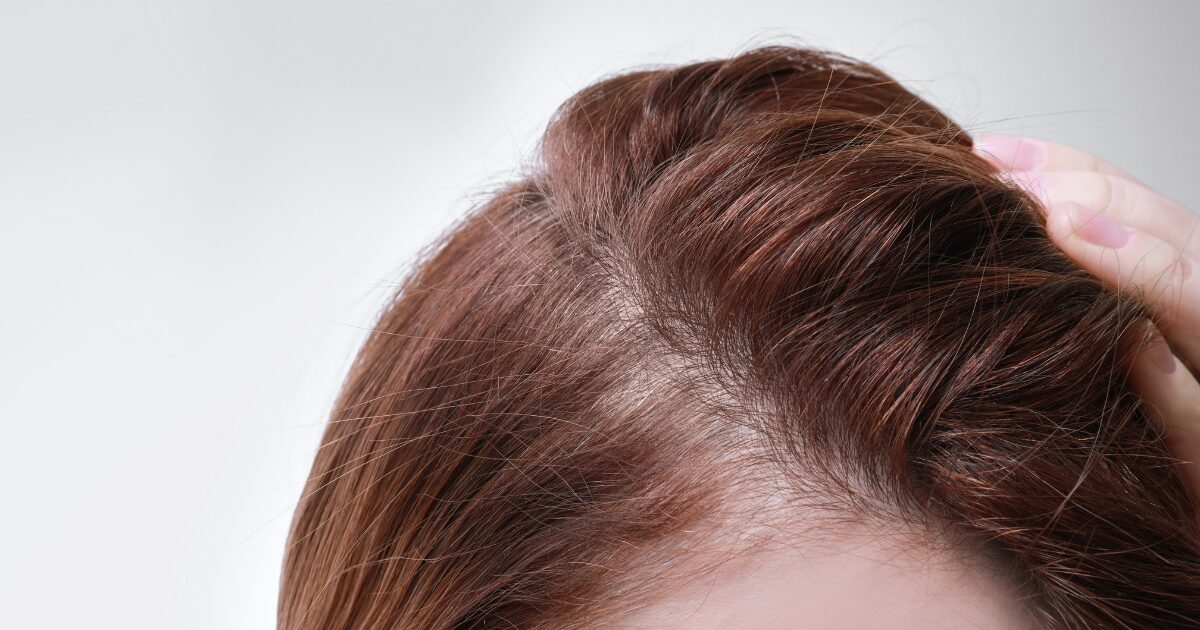 髪の分け目が気になる女性